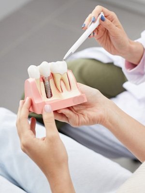 a patient holding a model of dental implants